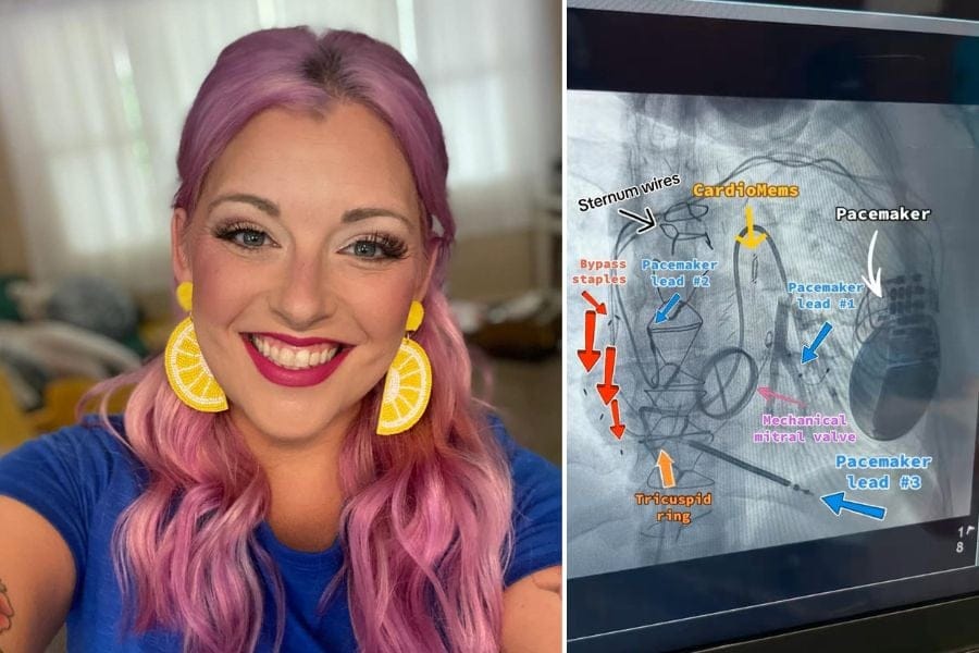 Alicia Nicoletti shares the story of decades-long battle to survive after a tragic car wreck.