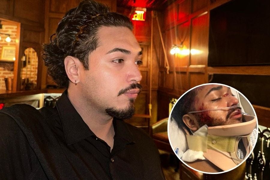 Photos of a Huntington Station man before his accident and in the hospital following the wreck.